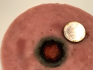 button battery, danger, first aid, accident prevention, stay safe