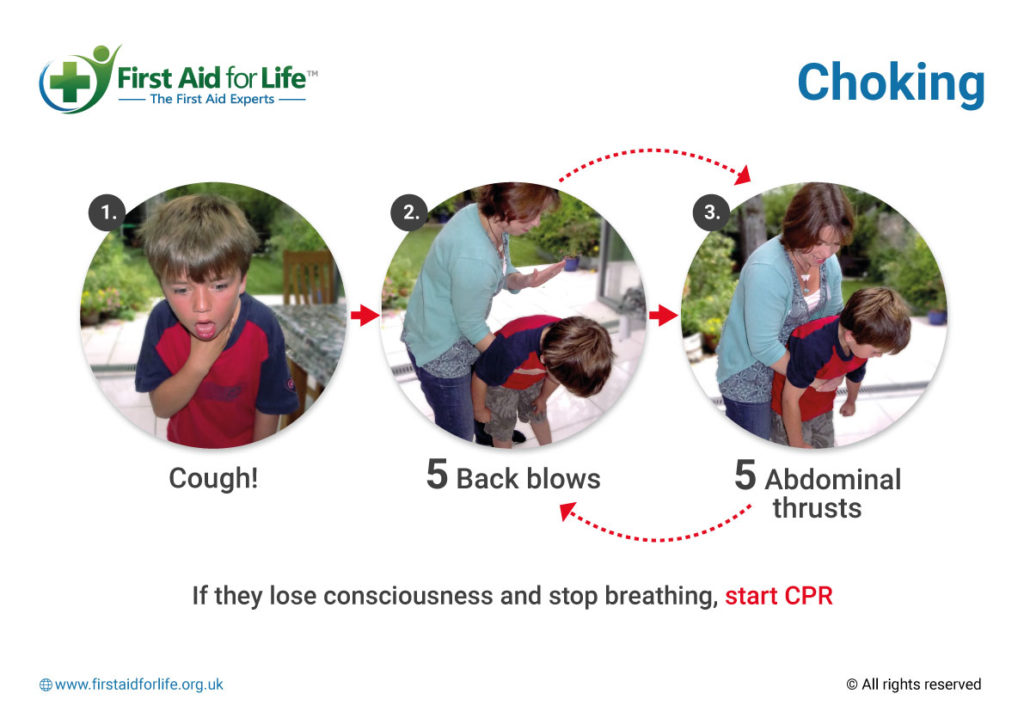 First Aid for Choking
