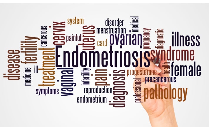 endometriosis diagnosis