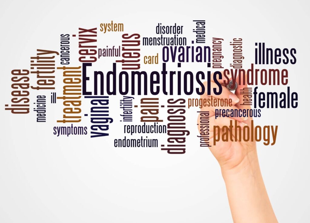 Endometriosis poses substantial burden
