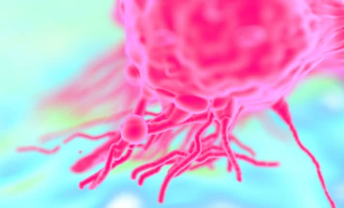 metastatic breast cancer