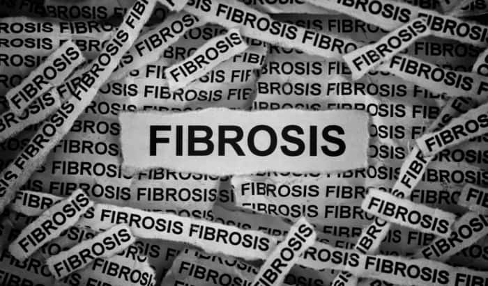fibrosis