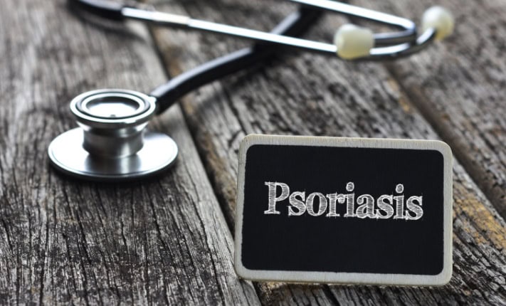 psoriasis
