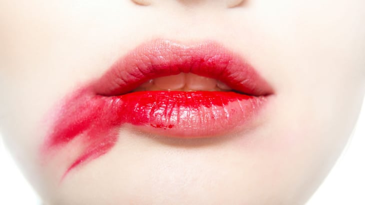 cervical cancer prevention