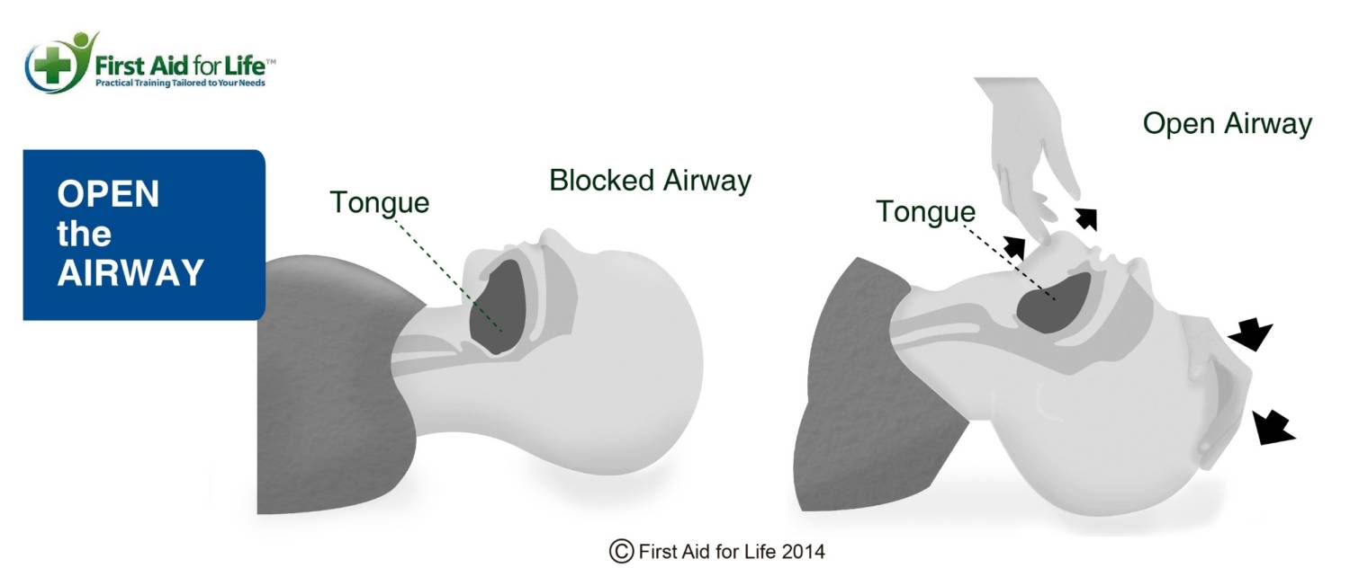 Why the recovery position saves lives