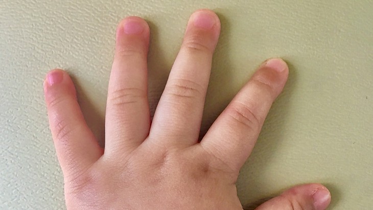 The Hippocratic Post - cholesterol levels