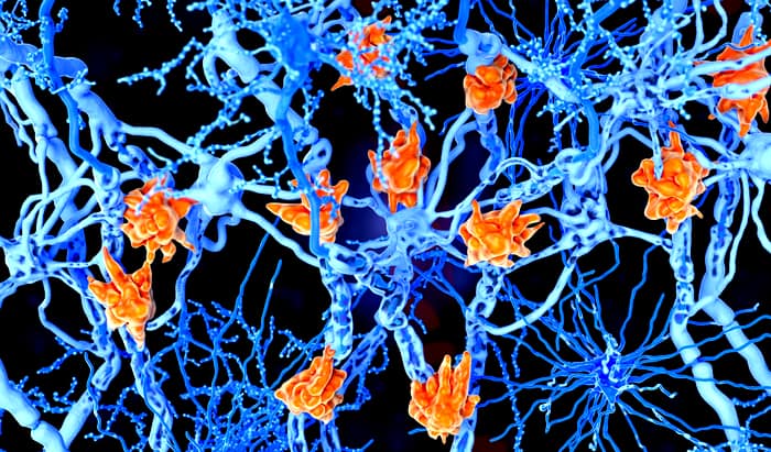 in its tracks stop MS