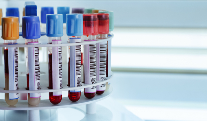 blood biomarker