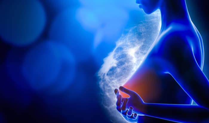 AI May Reduce Interval Breast Cancer Rates