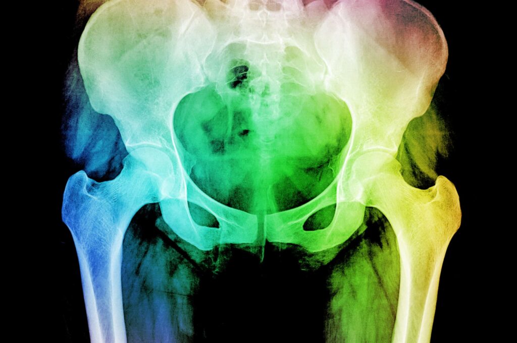gaps in radiotherapy follow up care
