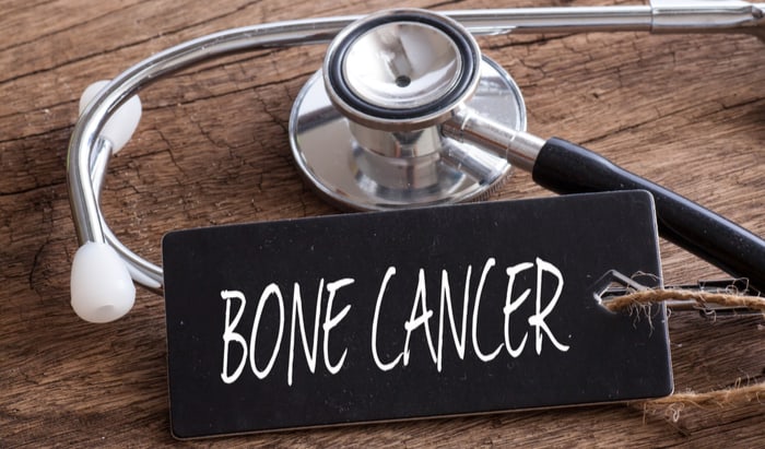 bone cancer