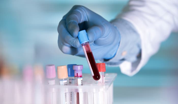 Inflammatory protein