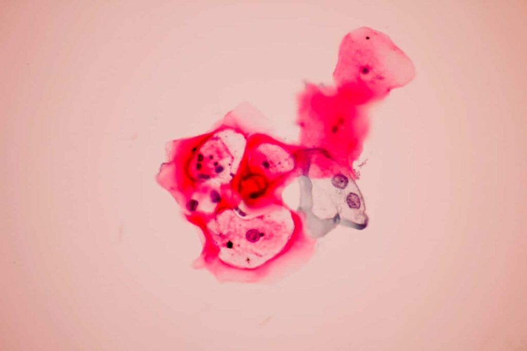 cervical cancer shame