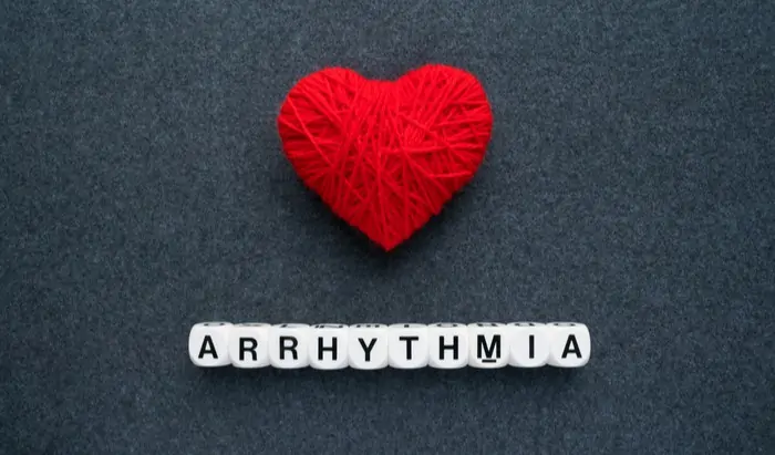 supraventricular tachycardia